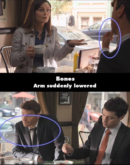 Bones picture